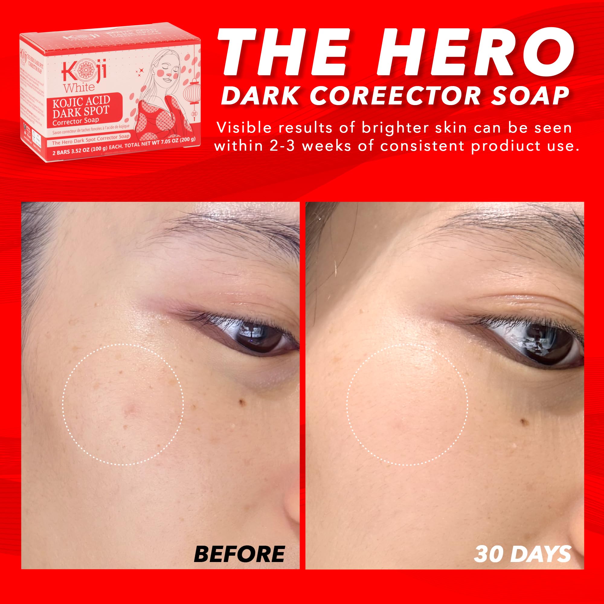 Koji White 4% Kojic Acid Dark Spot Corrector Soap For Exfoliating & Moisturizes with Vitamin C, Licorice Root Extract, Hydrating & Even Skin Tone Cleansing Bar for Face & Body, Vegan, 3.52 Oz (2 Bars)